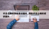 手足口病的预防常识图片_预防手足口病的症状图片